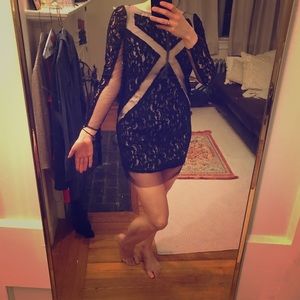 Tracy Reese lace overlay mini dress, Size small/XS